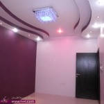 جبس سقق تهبل