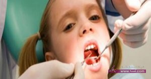 ما سبب تأخر ظهور الأسنان الدائمة بعد خلع اللبنية؟؟