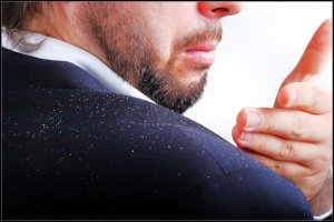 علاج قشرة الشعر