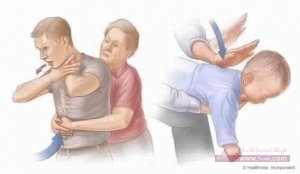 شرقة الأكل والإختناق بالطعام