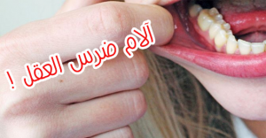 ١٠ مسكنات من صنع يديك لعلاج آلام ضرس العقل نهائي